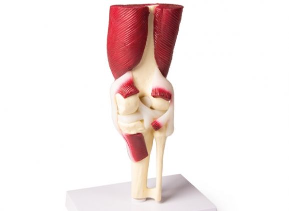https://jayakelana.id/uploads/product/-4662-knee-joint-life-8299968e157feef_cover.jpg