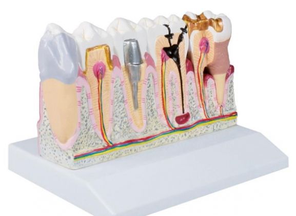 https://jayakelana.id/uploads/product/-d250-dental-model-4-74088418ba20bdb_cover.jpg