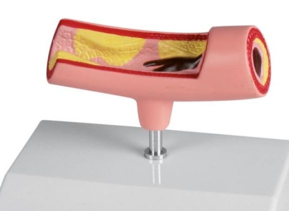 https://jayakelana.id/uploads/product/-g241-artery-model-772495449e734f5_cover.jpg