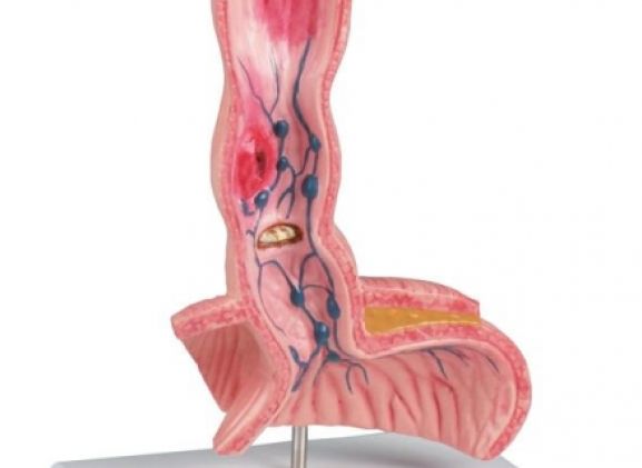 https://jayakelana.id/uploads/product/-k218-oesophagus-diseases-91822f04ad01eaf_cover.jpg