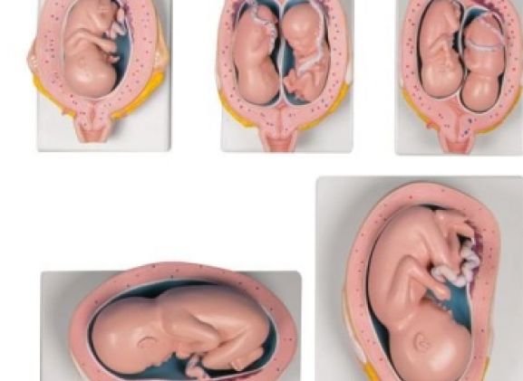 https://jayakelana.id/uploads/product/-l204-pregnancy-model-set--3240079c3983ebe_cover.jpg