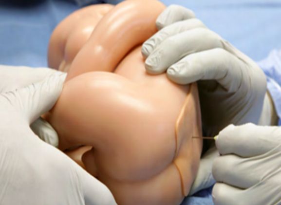 https://jayakelana.id/uploads/product/-lpb-40-lumbar-puncture-baby-752626142266041_cover.png