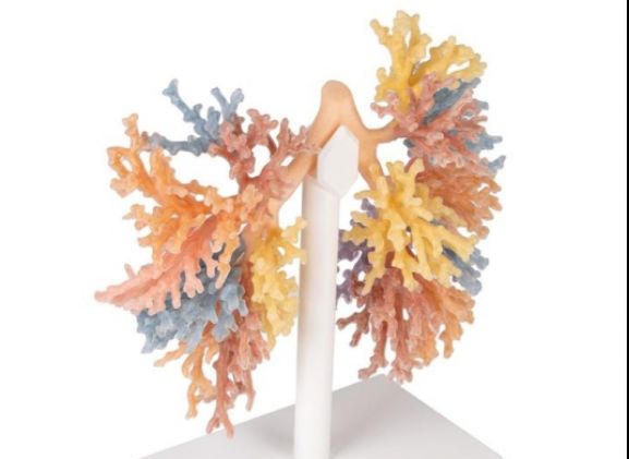 https://jayakelana.id/uploads/product/-mp1690-bronchial-tree-243324f35a34dc6_cover.jpg