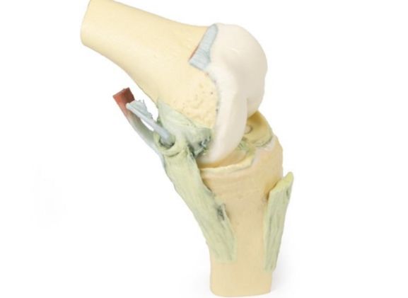 https://jayakelana.id/uploads/product/-mp1800-knee-joint-flexed-89418a7b40730c5_cover.jpg