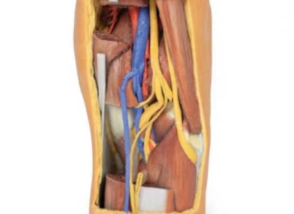 https://jayakelana.id/uploads/product/-mp1820-popliteal-fossa-distal-7454066ff46504e_cover.jpg