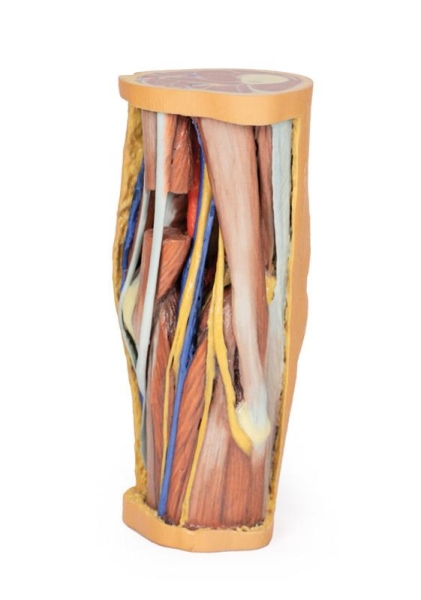 (MP1830) Popliteal Fossa