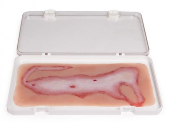 https://jayakelana.id/uploads/product/-nw108-wound-moulage-scalding-878556fa9e7b542_cover.jpg
