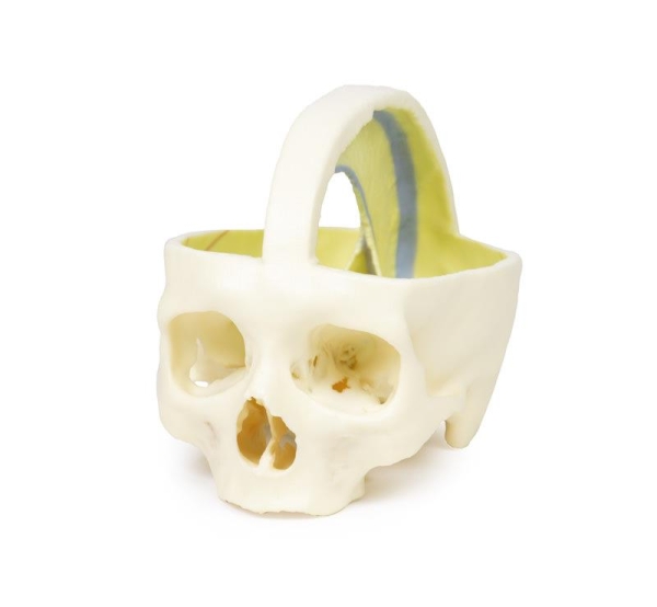 (MP1610) Dural Skull