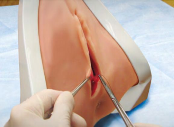 https://jayakelana.id/uploads/product/pelatih-perineal-perineal-prt-20--41963e3954c122f_cover.png