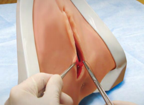 https://jayakelana.id/uploads/product/perineal-repair-replaceable-tissue-12948e3954c122f_cover.png