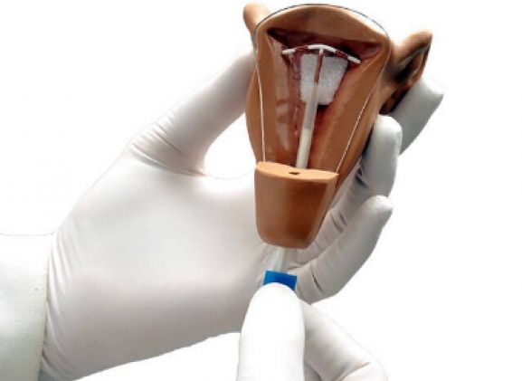 https://jayakelana.id/uploads/product/uterus-i-iud-placement-64463ffb81dc10c_cover.png